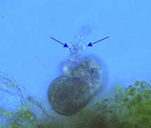 Colpoda eliminating waste