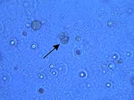 Colpoda forming cyst