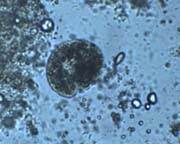 Colpoda creating currents