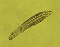 Bdelloidea Rotifer (Philodina)