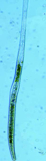 Spirostomum minus