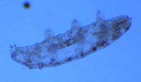 Tardigrade autopsy