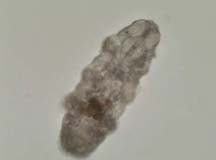 Tardigrade sp.