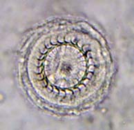 Trichodina sp.